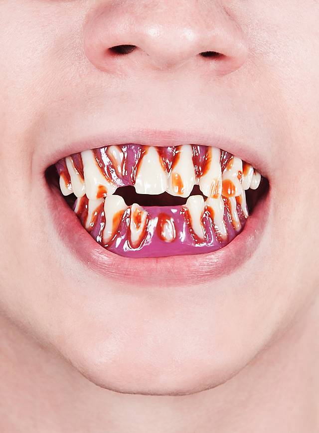 dental-fx-zombie-teeth--mw-109701-1.jpg