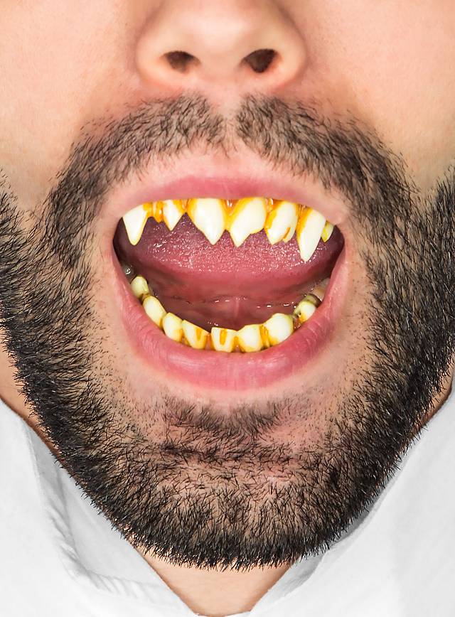 Horror-Zähne für Pennywise